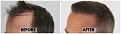 Click image for larger version

Name:	Before-After-LeftProfileAngle.jpg
Views:	168
Size:	103.6 KB
ID:	499711