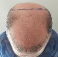 Click image for larger version

Name:	before.jpg
Views:	333
Size:	11.0 KB
ID:	499744