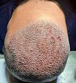 Click image for larger version

Name:	in the surgery .jpg
Views:	341
Size:	96.4 KB
ID:	499748