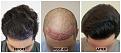 Click image for larger version

Name:	45Degree-9Months-Forum (1).jpg
Views:	205
Size:	99.1 KB
ID:	499812