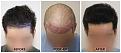 Click image for larger version

Name:	45Degree-Clinic-Forums copy.jpg
Views:	199
Size:	95.5 KB
ID:	499813