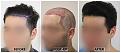 Click image for larger version

Name:	LeftProfileAngle-Clinic-Forums copy.jpg
Views:	206
Size:	92.0 KB
ID:	499814