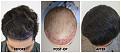 Click image for larger version

Name:	Top1-9Months-Forum (1).jpg
Views:	205
Size:	97.8 KB
ID:	499816