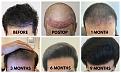 Click image for larger version

Name:	Timeline 0 to 9 Months - Forums (2).jpg
Views:	208
Size:	95.2 KB
ID:	499817
