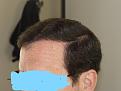 Click image for larger version

Name:	InkedP1590288.jpg
Views:	194
Size:	91.6 KB
ID:	499885