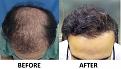 Click image for larger version

Name:	Comparison 2.jpg
Views:	286
Size:	34.5 KB
ID:	499912