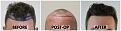 Click image for larger version

Name:	hairline-Forums.jpg
Views:	234
Size:	101.1 KB
ID:	500092