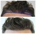 Click image for larger version

Name:	HairlineCloseup-Forums.jpg
Views:	223
Size:	85.6 KB
ID:	500094
