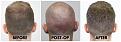 Click image for larger version

Name:	Donor-Forums.jpg
Views:	222
Size:	100.8 KB
ID:	500096