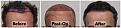 Click image for larger version

Name:	Hairline-Forums.jpg
Views:	229
Size:	108.3 KB
ID:	500404