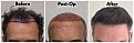 Click image for larger version

Name:	Hairline-Forum.jpg
Views:	199
Size:	100.6 KB
ID:	500417