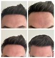 Click image for larger version

Name:	HairlineCloseup.jpg
Views:	208
Size:	92.3 KB
ID:	500420