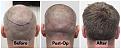 Click image for larger version

Name:	Donor-Forum (2).jpg
Views:	189
Size:	101.2 KB
ID:	500421