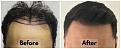 Click image for larger version

Name:	Hairline-Forum.jpg
Views:	219
Size:	96.4 KB
ID:	500448