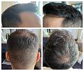 Click image for larger version

Name:	TakenByPatient-12Months2ndHT.jpg
Views:	180
Size:	97.5 KB
ID:	500455