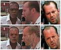 Hair loss in Temple.jpg