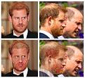 Hair loss in crown.jpg