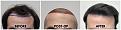 Click image for larger version

Name:	Hairline-Forum.jpg
Views:	186
Size:	106.1 KB
ID:	500529