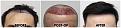 Click image for larger version

Name:	Hairline-Forum.jpg
Views:	214
Size:	106.0 KB
ID:	500542