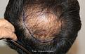 Click image for larger version

Name:	AM9.jpg
Views:	151
Size:	98.8 KB
ID:	500587