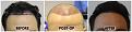 Click image for larger version

Name:	Hairline-Forum.jpg
Views:	220
Size:	105.2 KB
ID:	500774