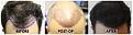 Click image for larger version

Name:	45Degrees-Forum.jpg
Views:	219
Size:	106.6 KB
ID:	500775