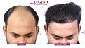 Click image for larger version

Name:	Slide6.jpg
Views:	1845
Size:	96.3 KB
ID:	500841