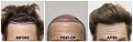 Click image for larger version

Name:	Hairline-Forum.jpg
Views:	212
Size:	102.8 KB
ID:	500890