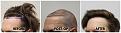Click image for larger version

Name:	LeftAngle-Forum.jpg
Views:	190
Size:	100.5 KB
ID:	500894