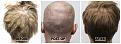 Click image for larger version

Name:	Donor-Forum.jpg
Views:	191
Size:	103.3 KB
ID:	500899