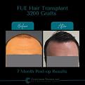 Click image for larger version

Name:	BeforeAfter .jpg
Views:	328
Size:	9.4 KB
ID:	500917