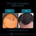 Click image for larger version

Name:	BeforeAfter -3.jpg
Views:	291
Size:	10.5 KB
ID:	500919