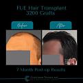 Click image for larger version

Name:	BeforeAfter -4.jpg
Views:	310
Size:	9.9 KB
ID:	500920