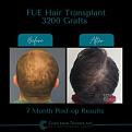 Click image for larger version

Name:	BeforeAfter -5.jpg
Views:	305
Size:	10.6 KB
ID:	500921