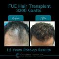 Click image for larger version

Name:	BeforeAfter .jpg
Views:	282
Size:	12.6 KB
ID:	500922