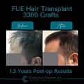 Click image for larger version

Name:	BeforeAfter -2.jpg
Views:	261
Size:	11.9 KB
ID:	500923