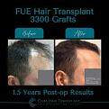Click image for larger version

Name:	BeforeAfter -3.jpg
Views:	266
Size:	12.3 KB
ID:	500924