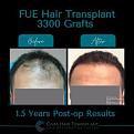 Click image for larger version

Name:	BeforeAfter -4.jpg
Views:	265
Size:	11.9 KB
ID:	500925