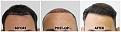 Click image for larger version

Name:	Hairline-Forum.jpg
Views:	219
Size:	99.3 KB
ID:	500962