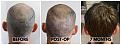 Click image for larger version

Name:	Donor-Forum.jpg
Views:	205
Size:	101.3 KB
ID:	500964