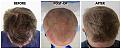 Click image for larger version

Name:	Top-Forum.jpg
Views:	169
Size:	96.8 KB
ID:	500989