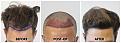 Click image for larger version

Name:	45Degree-Forum.jpg
Views:	157
Size:	98.0 KB
ID:	501030