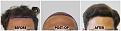 Click image for larger version

Name:	Hairline-Forum.jpg
Views:	148
Size:	102.4 KB
ID:	501031
