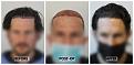 Click image for larger version

Name:	Hairline-Forum.jpg
Views:	162
Size:	84.5 KB
ID:	501069