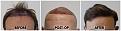 Click image for larger version

Name:	Hairline-Forum.jpg
Views:	147
Size:	100.8 KB
ID:	501108
