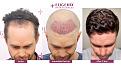Click image for larger version

Name:	Slide4.jpg
Views:	185
Size:	92.4 KB
ID:	501119