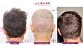 Click image for larger version

Name:	Slide8.jpg
Views:	176
Size:	95.8 KB
ID:	501123