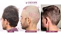 Click image for larger version

Name:	Slide10.jpg
Views:	194
Size:	96.6 KB
ID:	501125