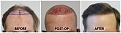 Click image for larger version

Name:	Hairline-Forum.jpg
Views:	147
Size:	104.4 KB
ID:	501156
