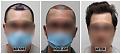 Click image for larger version

Name:	Hairline-Forum.jpg
Views:	248
Size:	88.6 KB
ID:	502070